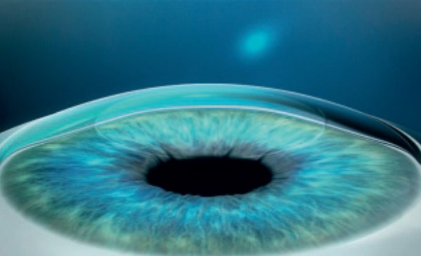 Step 3: Eye condition corrected
